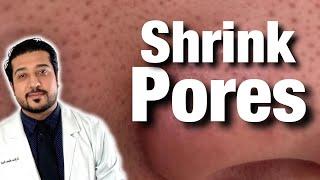 How to Shrink Pores For Good | Get Rid of Pores on Nose FAST (2021)