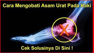 Cara Mengobati Asam Urat Pada Kaki Dengan Obat Pilihan Terbaik