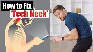Fix Forward Head Posture - 3 Exercises to Reverse ‘Tech Neck’