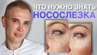 НОСОСЛЕЗКА что нужно знать? #носослезка