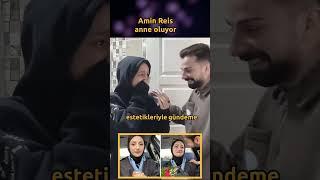 En son yüzünü yakmasıyla ve estetikleriyle gündeme gelen Amin Reis'ten sürpriz bir haber geldi! Gözy