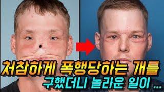 [이슈]얼굴 이식한 한 남자의 놀라운 사연 - 감동이슈