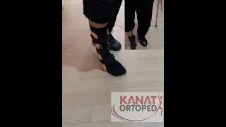 Orthoprotez-Semi protez-Kısalık protezi-semi prosthetic-Kısalık malformasyonu-Kısalık giderici