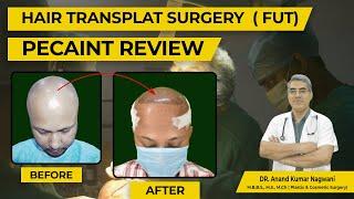 BEST HAIR TRANSPLANT IN KOLKATA | HAIR TRANSPLANT SURGERY