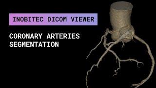 Coronary arteries segmentation in Inobitec DICOM Viewer Pro