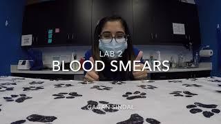 Lab 2 Blood Smear