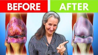 HEAL Joint Pain And Arthritis VERY FAST In 1 WEEK! | Barbara O'Neill