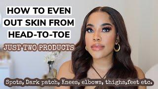 HOW TO COMPLETELY CLEAR HYPERPIGMENTATION AND DARK PATCHES TO EVEN OUT SKINTONE FROM HEAD TO TOE