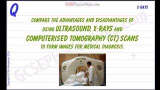 Ultrasound vs X-ray Photography and CT Scans - Advantages and Disadvantages - GCSE Physics