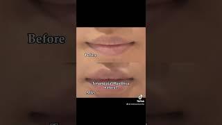 Rahasia bibir sexy impian para Ladies nih!