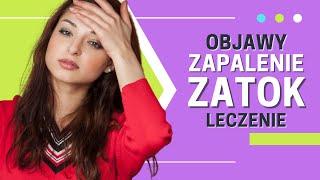 Zapalenie zatok leczenie  objawy zapalenia zatok