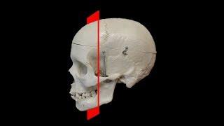 How to Read CT Sinus Scans - A Layperson's Guide