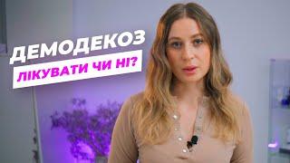 ДЕМОДЕКОЗ | Лікувати чи ні?