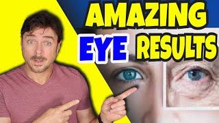 Ancient Oil Reverses EYE SKIN Aging Issues! | Chris Gibson