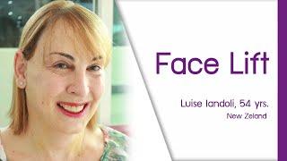 Looks young by Face Lift Surgery