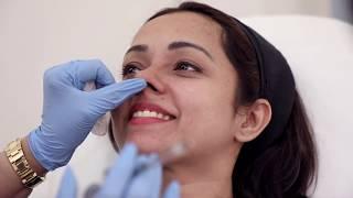 The 5 Minute Nose Job - Non Surgical Rhinoplasty - Beauty Secrets with Dr. Jamuna Pai