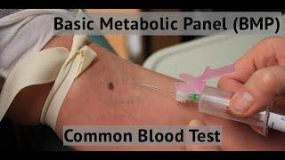 What is Basic Metabolic Panel? Learn it in 1 minute, What is included in Chem-7 Panel?