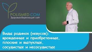 Виды родинок (невусов): врожденные и приобретенные, плоские и выпуклые, сосудистые и несосудистые