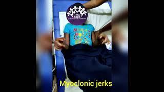 MYOCLONIC JERKS