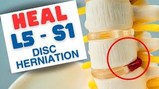 L5-S1 Disc Herniation Symptoms & Non-Surgical Treatment Methods | Dr. Marc Dupuis Chiropractor in ME