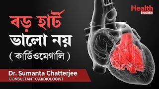 কার্ডিওমেগালি  বা বড় হার্ট বা কি ভালো ? What is Cardiomegaly or Enlarged heart & it’s treatment