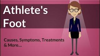 Athlete's Foot -  Causes, Symptoms, Treatments & More…