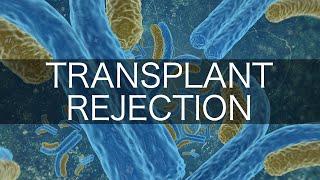 Transplant Rejection