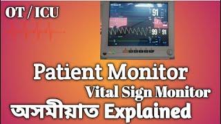 ICU /OT patient monitor / vital sign monitor / muun medical tech / Monitor explaned