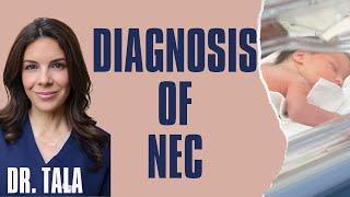 LABS/ X-rays/ physical exam findings and pertinent history used in DIAGNOSIS of NEC. PART II