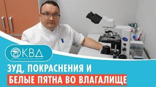  Зуд, покраснения и белые пятна во влагалище. Клинический случай №895