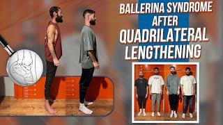 BALLERINA SYNDROME AFTER QUADRILATERAL LENGTHENING