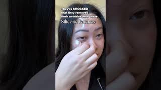 They’re SHOCKED that they removed their wrinkles with these Silicone Patches!