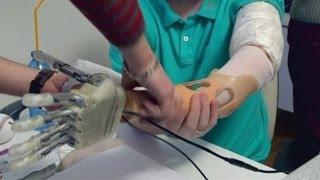 First bionic hand with real feeling