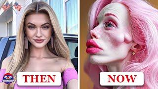 27 Celebrities Before and After Plastic Surgery I then and now 2025