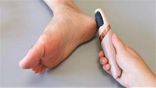 Electric Foot Callus Remover Unboxing and Review - Scam or Legit??