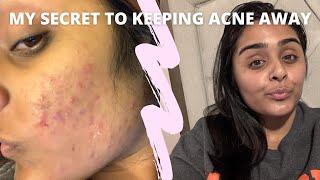 GET RID OF ADULT HORMONAL ACNE