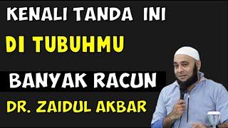 INI TANDA TANDA TUBUH BANYAK RACUN DAN PERLU SEGERA DI DETOKS - DR ZAIDUL AKBAR #ResepSehat