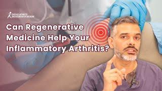 Can Regenerative Medicine Help Manage Inflammatory Arthritis?