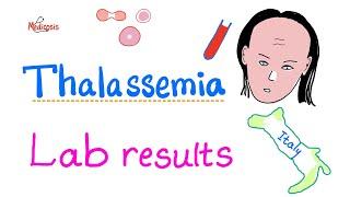 Thalassemia - Lab Results - How To Diagnose Thalassemia - Hematology Series