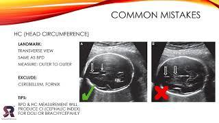 INTRODUCTION TO OBSTETRICS ULTRASOUND FOR NEWBIE