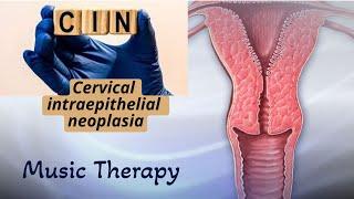 Cervical intraepithelial neoplasia [CIN ] // Dysplasia //  Music therapy // Recommendations