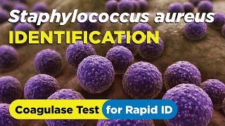 How to identify Staphylococcus aureus using the Coagulase Test - Slide and Tube Method