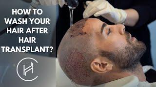 HOW TO WASH YOUR HAIR AFTER A HAIR TRANSPLANT?  |  HEVA CLINIC