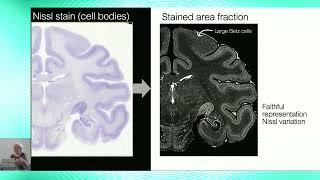 8th BigBrain Workshop 2024: The BigMac Dataset...