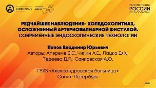 Редчайшее наблюдение- холедохолитиаз, осложненный артериобилиарной фистулой.