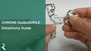 CHROME GuidedSMILE - Osteotomy Guide