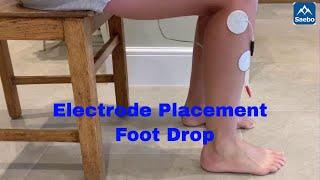 Electrode Placement for foot drop