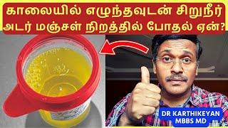 urine infection treatment