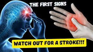 8 Signs of an imminent STROKE! The body warns, DO NOT Miss it - YOU WILL SURVIVE