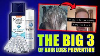 "The Big 3" Hair Loss Prevention Protocol Before And After 10 YEARS LATER